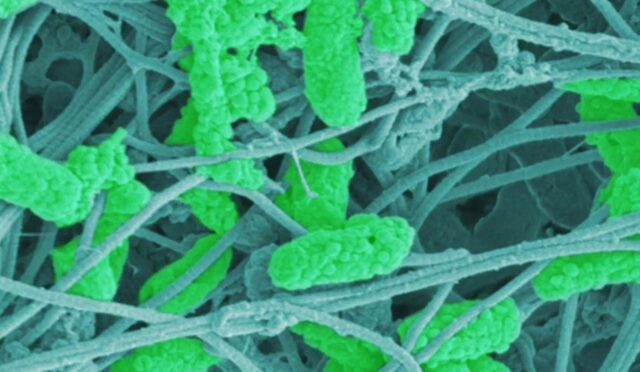 bakterilerden-olusan-yeni-pansuman-yontemi-kronik-yaralarin-iyilesmesine-yardimci-olabilir-LdQqhcZ2.jpg